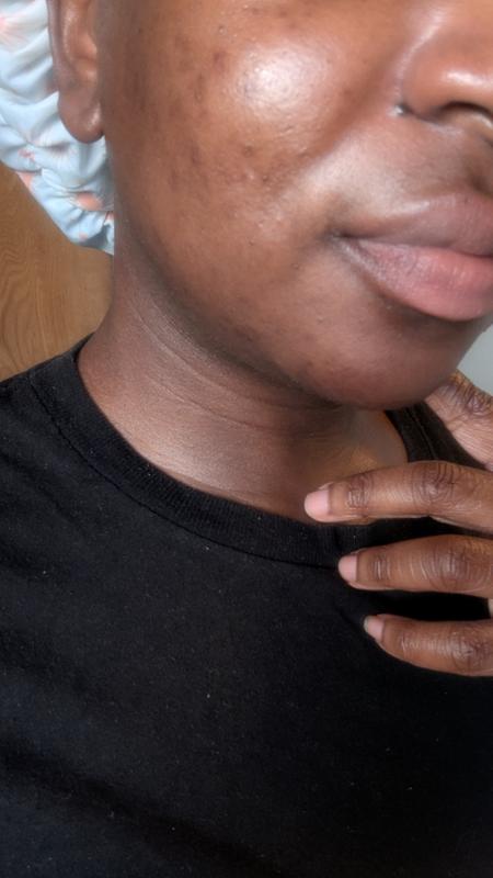 Review Thumbnail Image 1 240392481