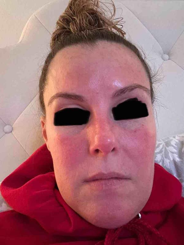 Review Thumbnail Image 0 242017254