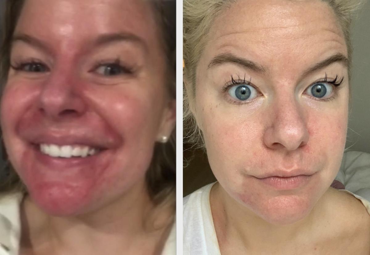 Review Thumbnail Image 0 205137932