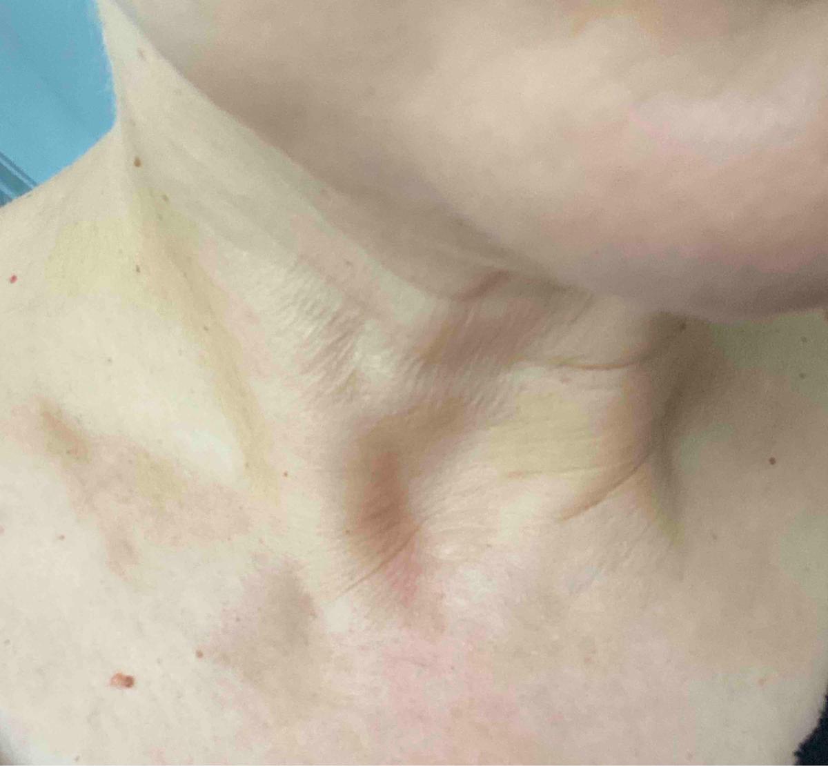 Review Thumbnail Image 0 199481370