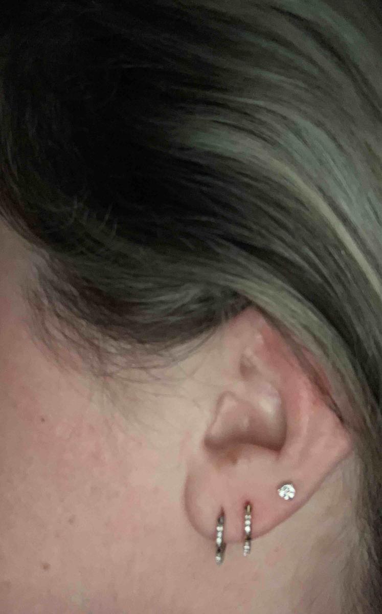 Review Thumbnail Image 0 205738419