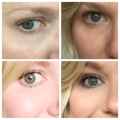 Review Thumbnail Image 0 94516294