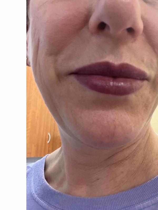 Review Thumbnail Image 0 231915892