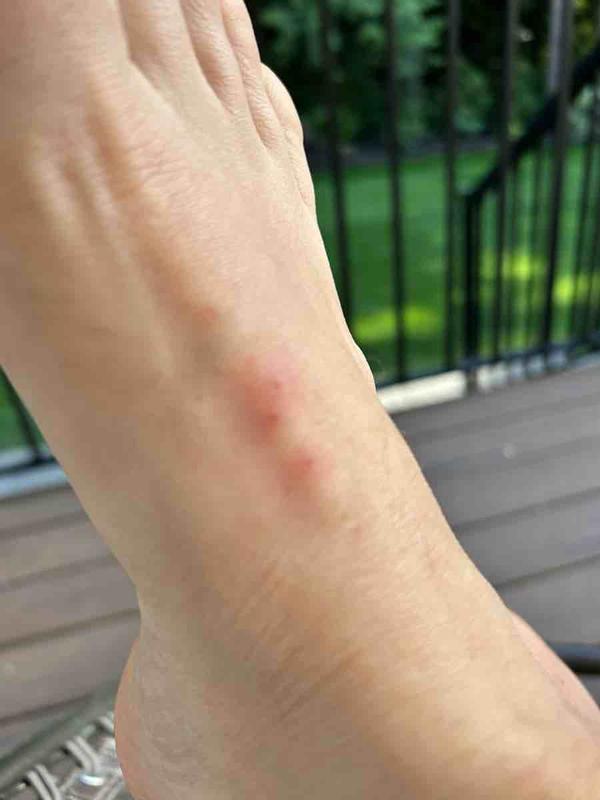 Review Thumbnail Image 0 242252717