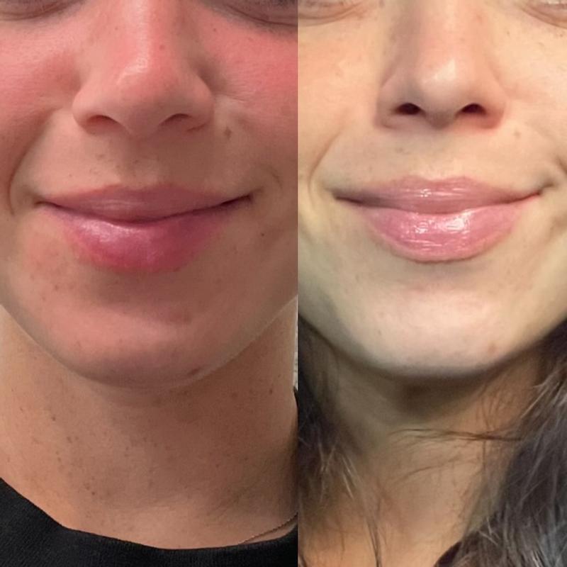 Review Thumbnail Image 0 229389152