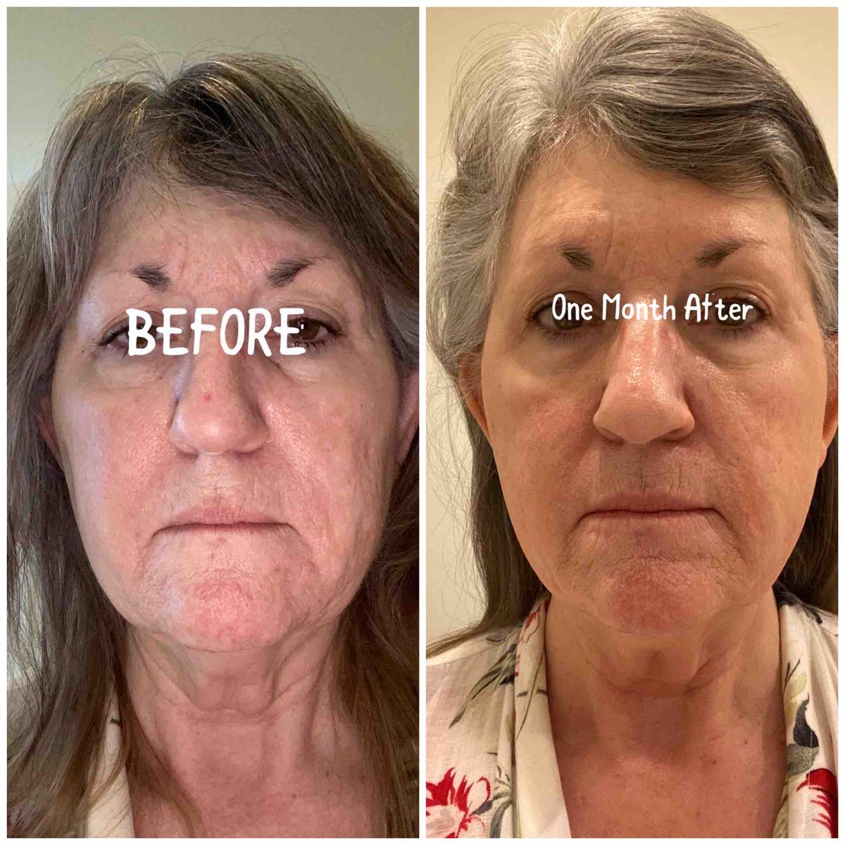 Review Thumbnail Image 0 206143939