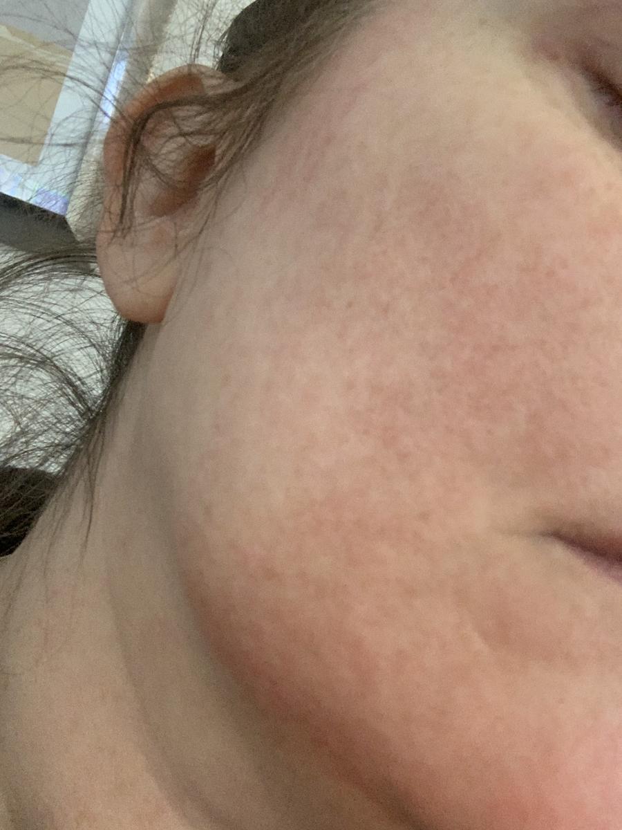 Review Thumbnail Image 0 204564706