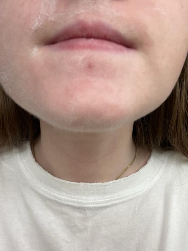 Review Thumbnail Image 0 220652632