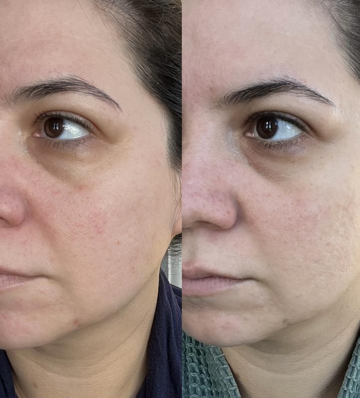 Review Thumbnail Image 0 245642806