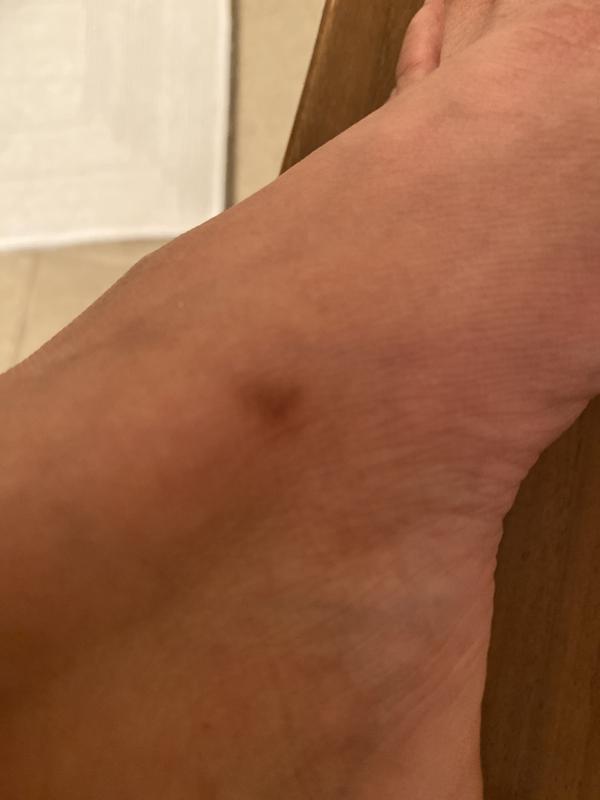 Review Thumbnail Image 2 216316923