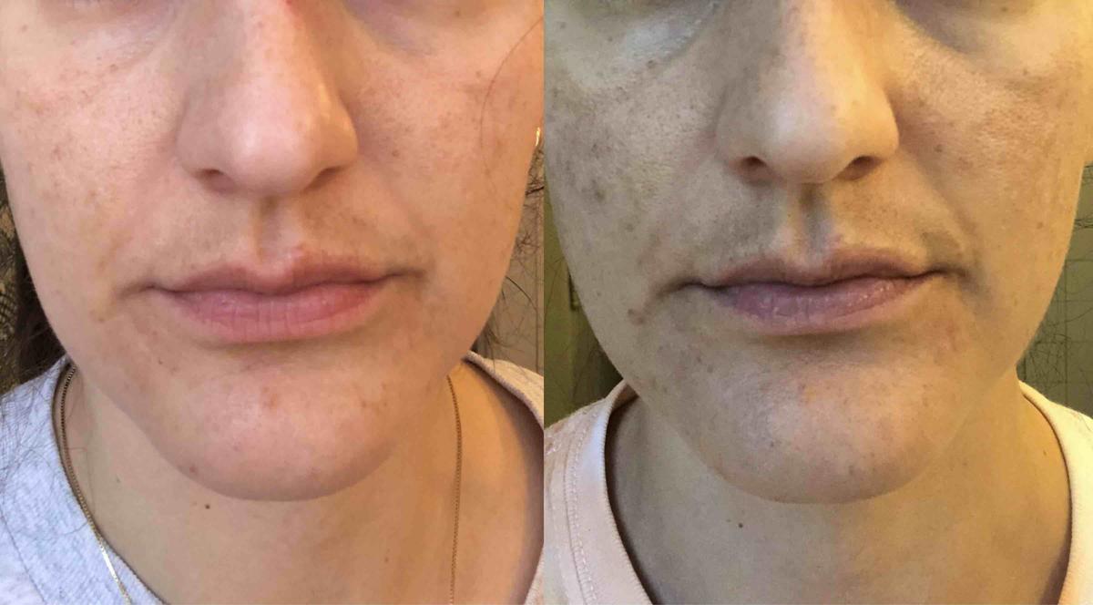 Review Thumbnail Image 0 204850614