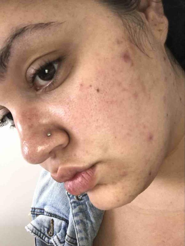 Review Thumbnail Image 0 238347224