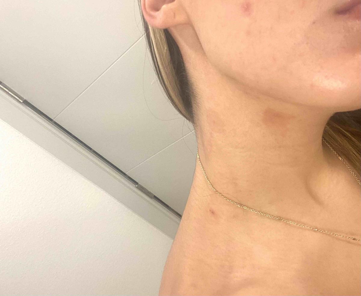 Review Thumbnail Image 0 210101540