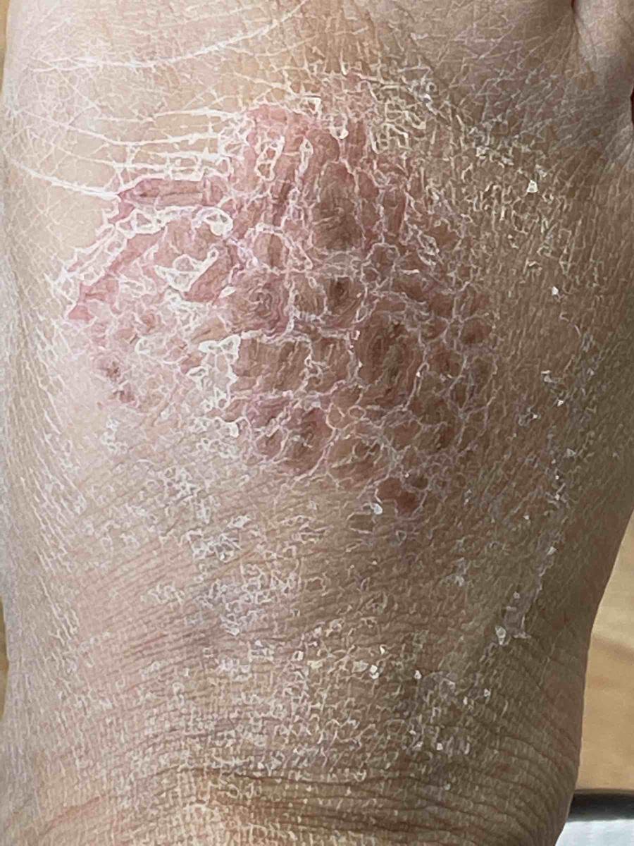 Review Thumbnail Image 0 206853122