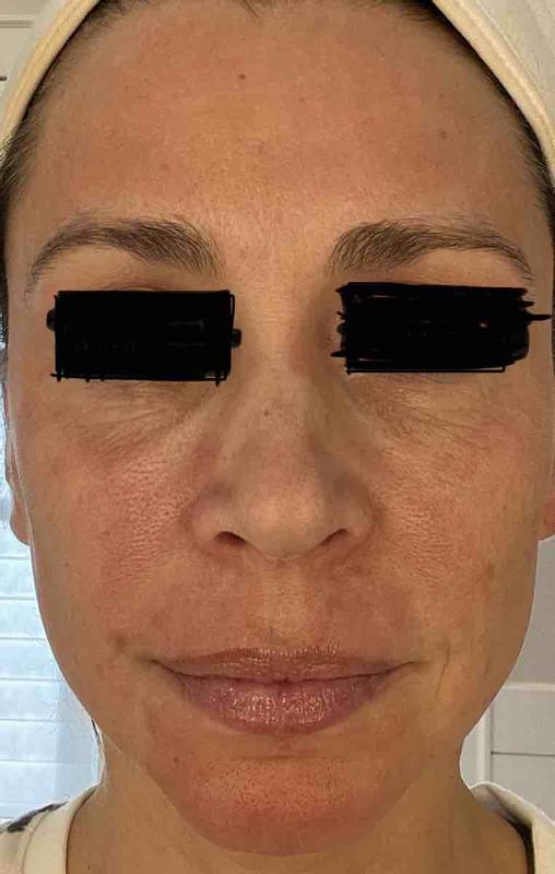 Review Thumbnail Image 0 223690296