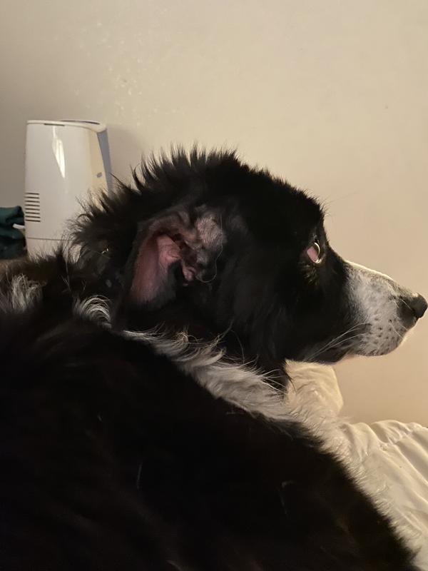 Ear surgery