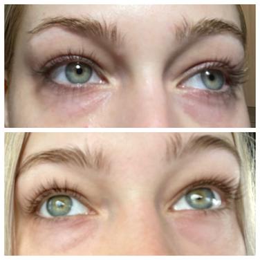 bright eye complex reviews