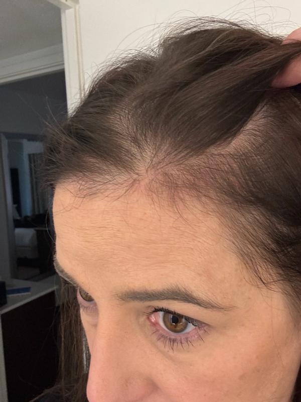 Review Thumbnail Image 0 379952124