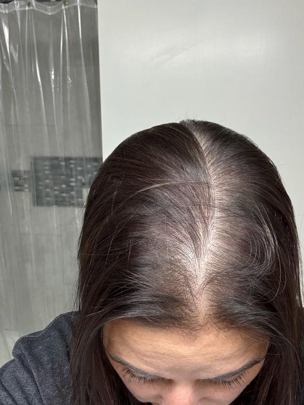 Review Thumbnail Image 2 379952124