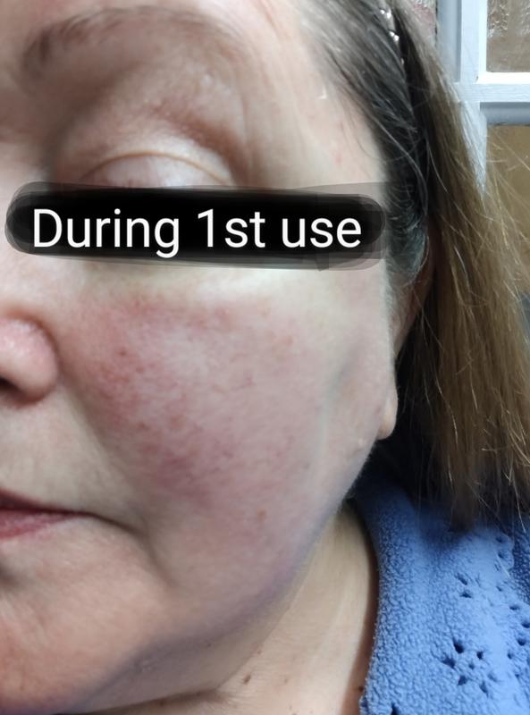 User generated review image 3