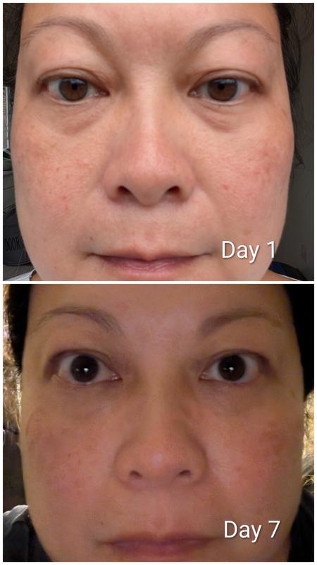 Customer photo — Shark CryoGlow Clinic
