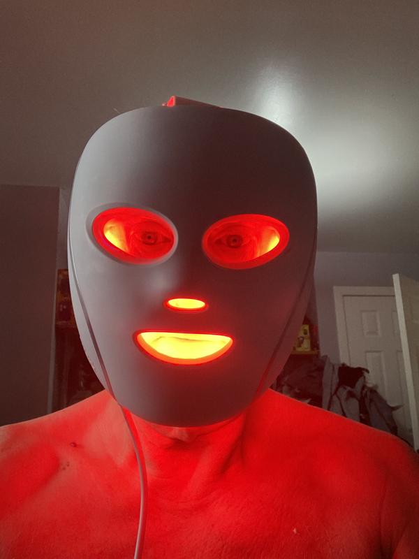 Customer photo — Shark CryoGlow Clinic