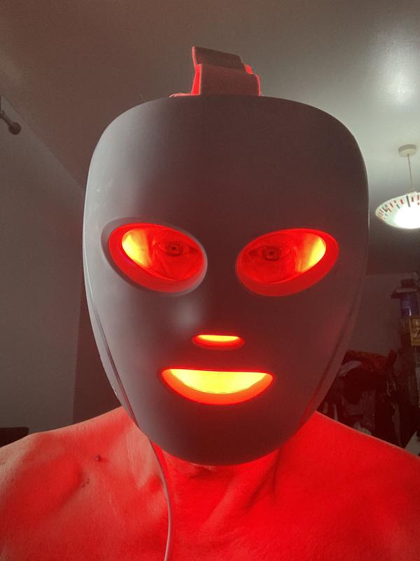 Customer photo — Shark CryoGlow Clinic
