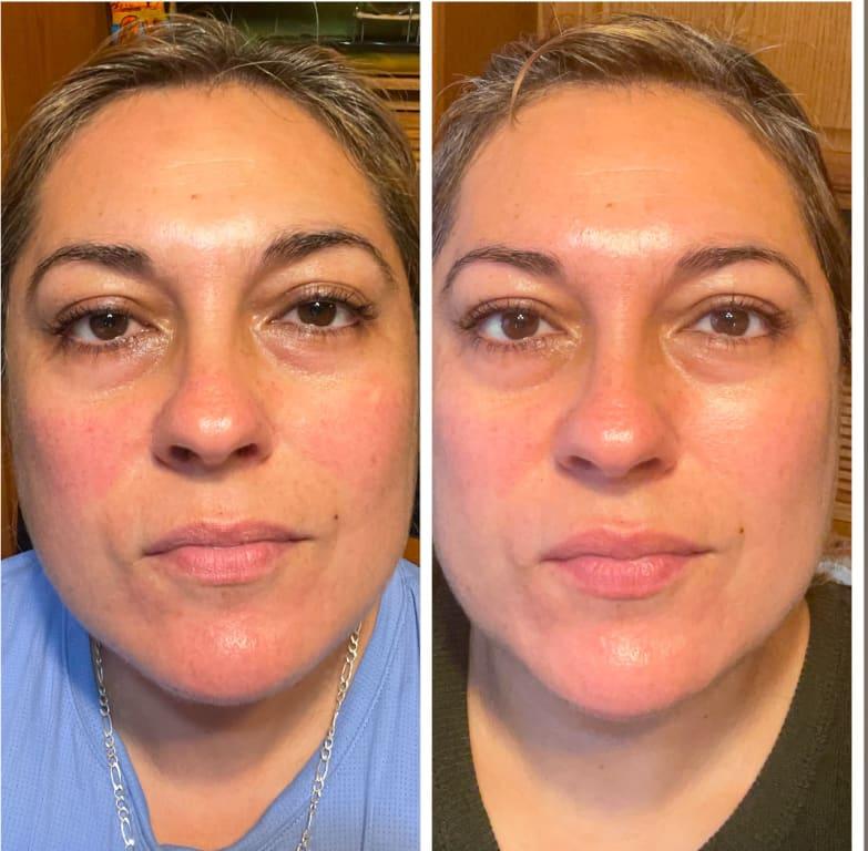 Shiseido Eye and Lip Contour Regenerating Cream | MECCA Shiseido Eye and Lip Contour Regenerating Cream | MECCA