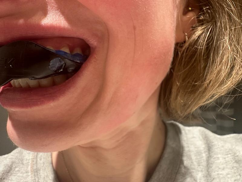 Photo submitted with review of product