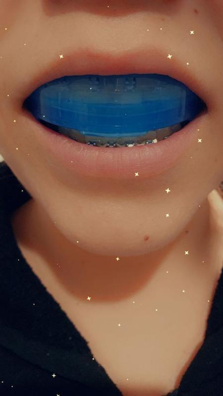 Photo submitted with review of product