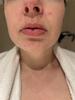 Skin without concealer