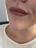 This is after a lot of blotting