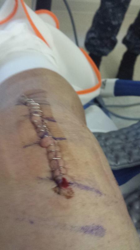 Photo submitted with review of product