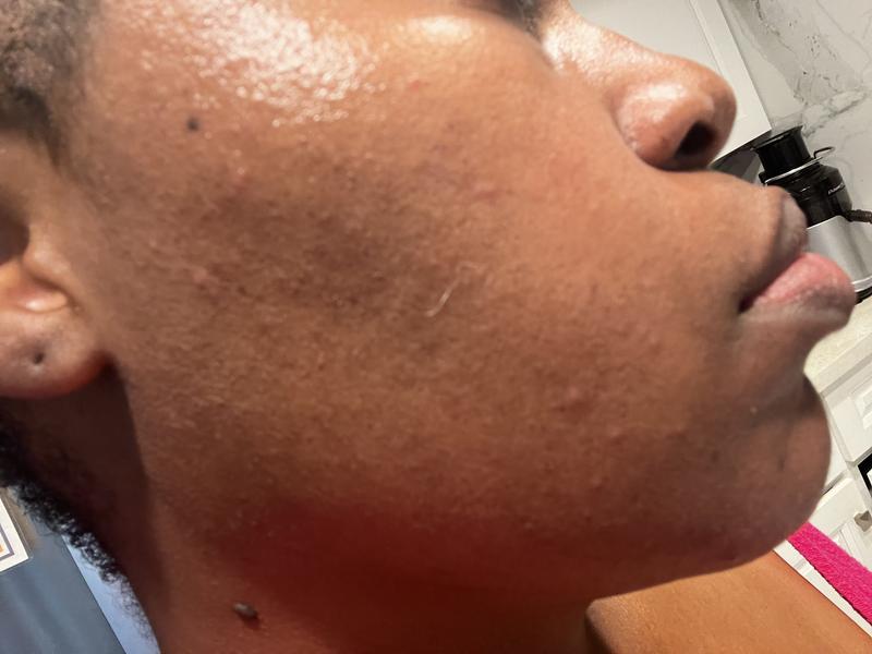 Review Thumbnail Image 0 316376438