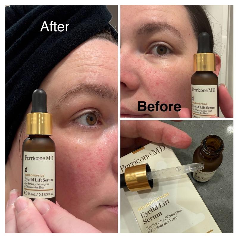 perricone md essential fx acyl-glutathione eyelid lift serum reviews Glutathione Foods Stock Photos