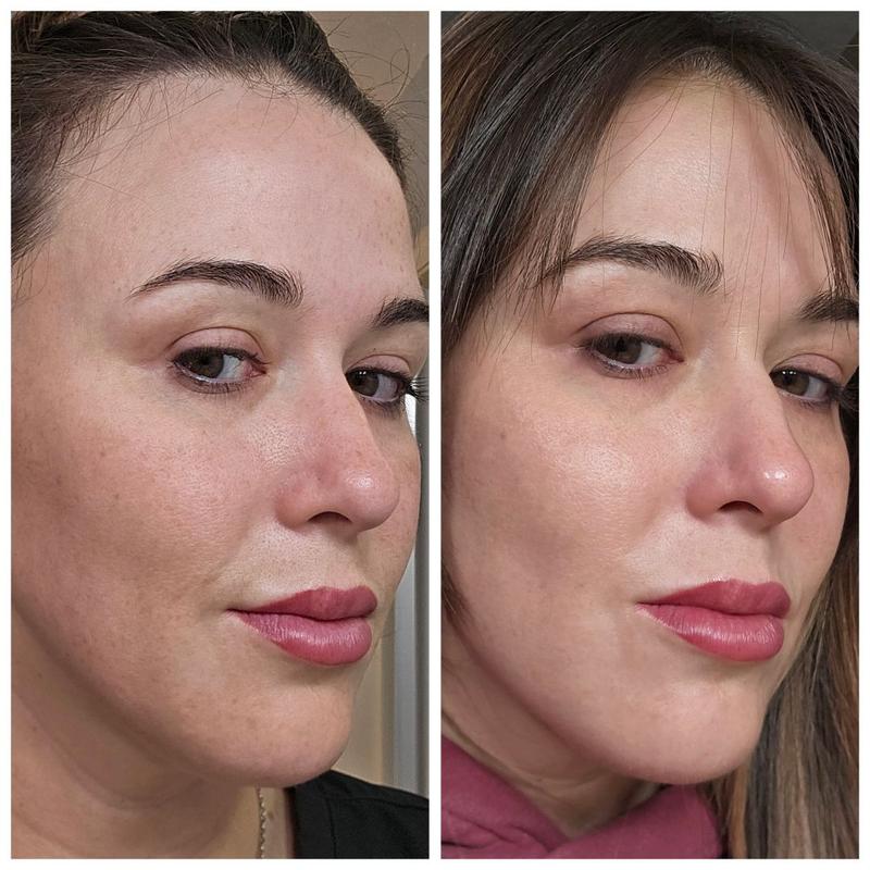 Neuropeptide Deep Crease Serum | Perricone MD