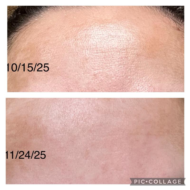 Neuropeptide Deep Crease Serum | Perricone MD