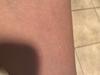 User submitted photo