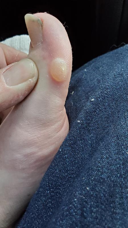 Photo submitted with review of product