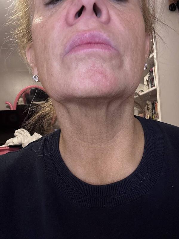 Review Thumbnail Image 0 341787927