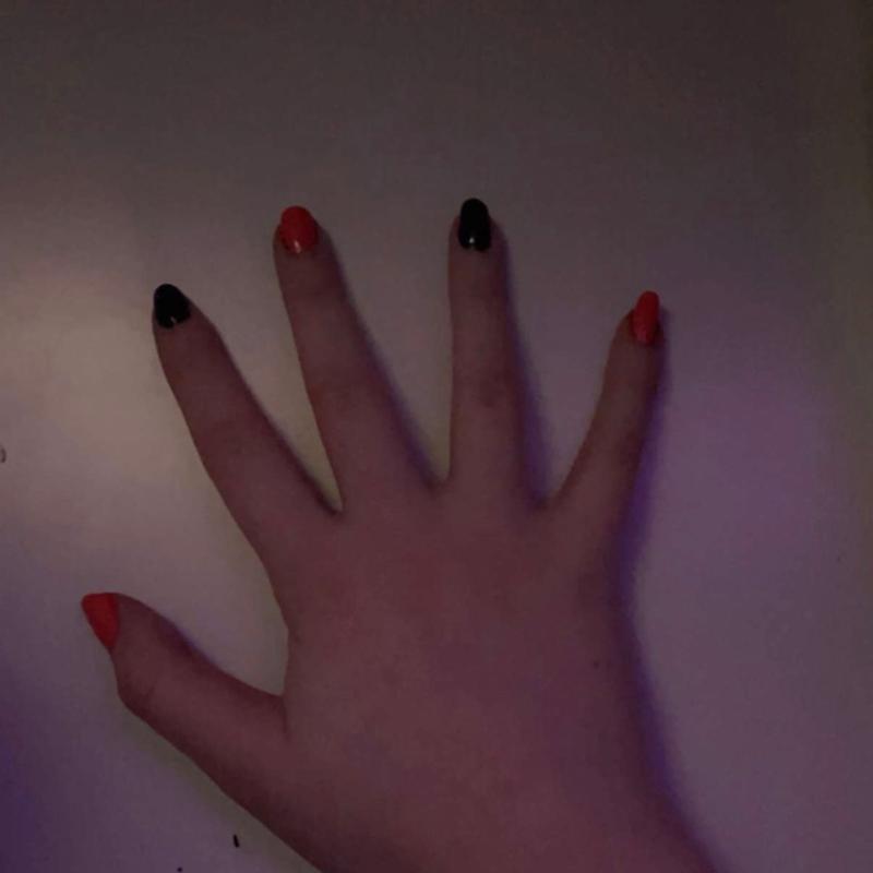 Bruised Knuckles From Punching A Wall