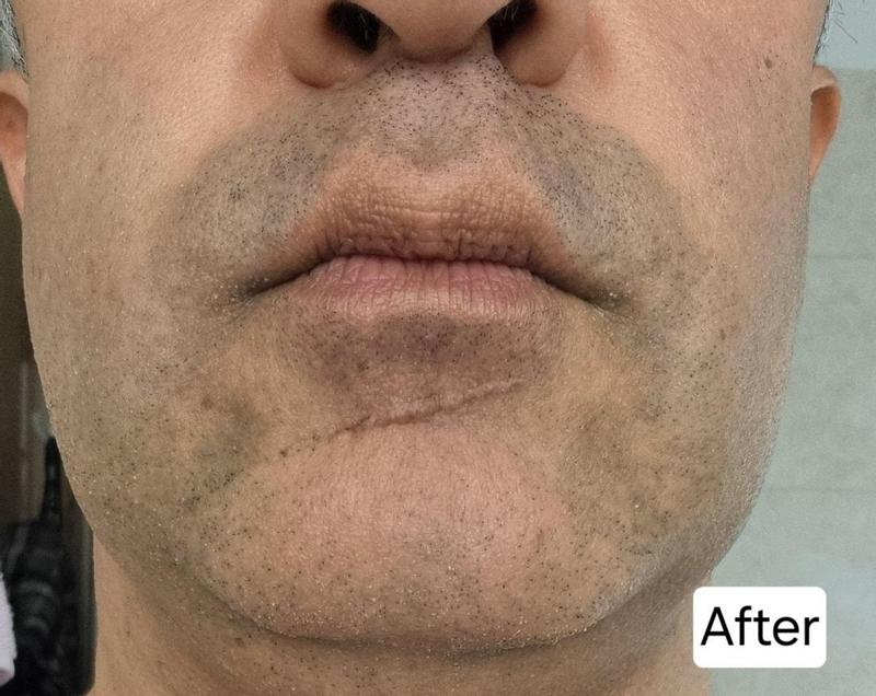 User generated review image 3