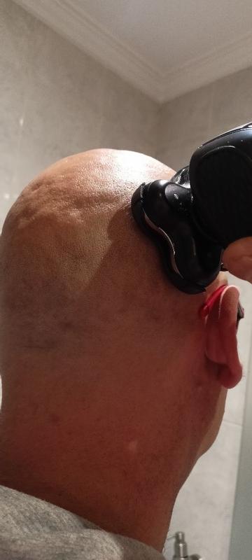 Revisione aperta modale 2 su 2