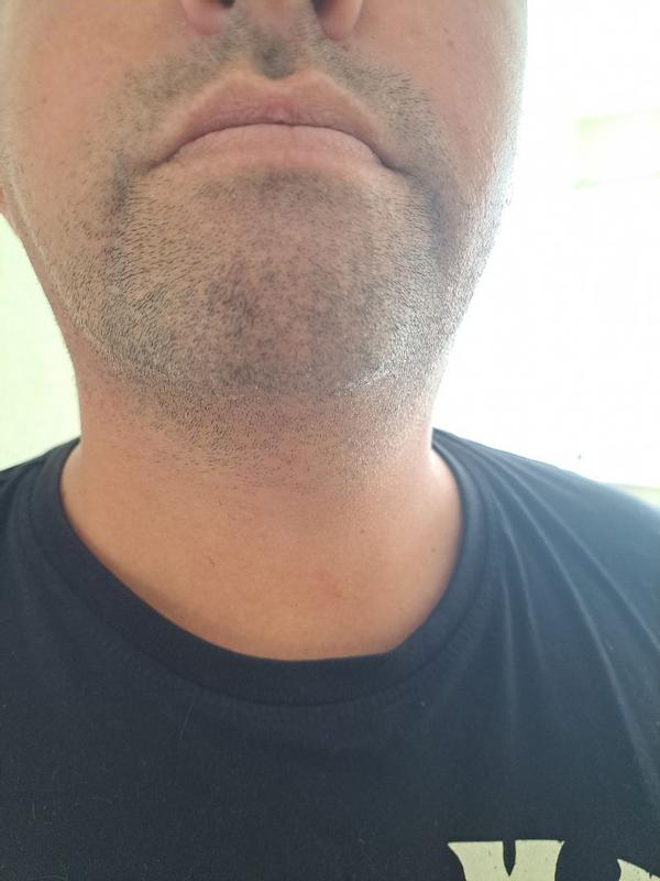 User generated review image 3