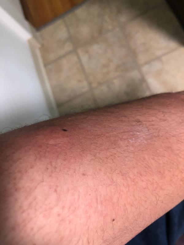 Photo submitted with review of product