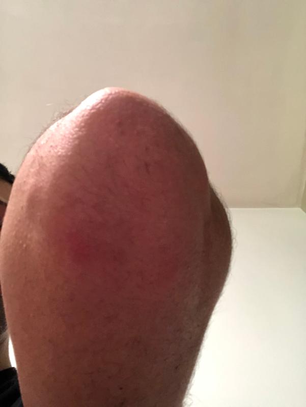 Photo submitted with review of product