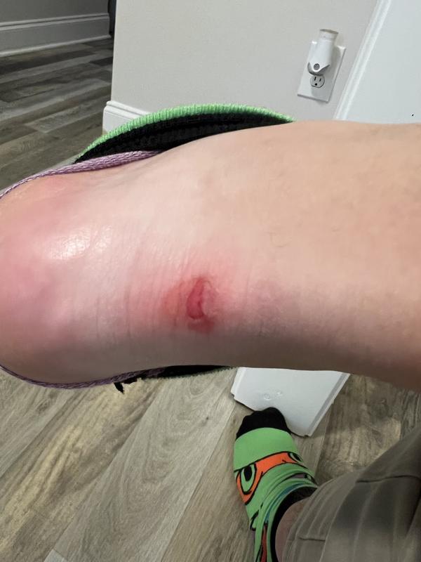 Photo submitted with review of product