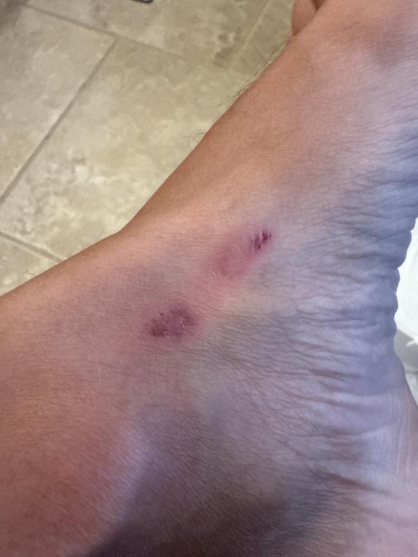 Photo submitted with review of product