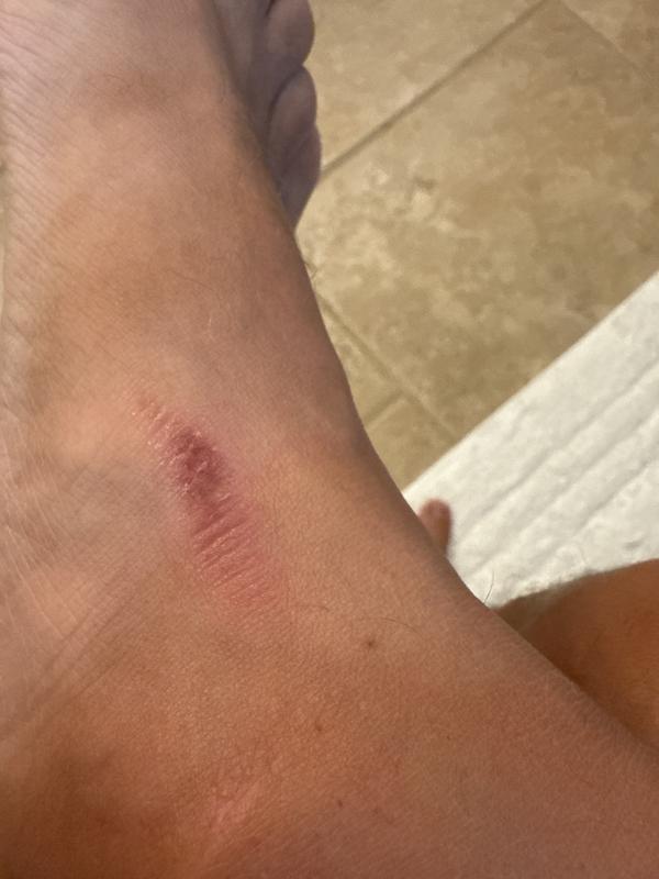 Photo submitted with review of product