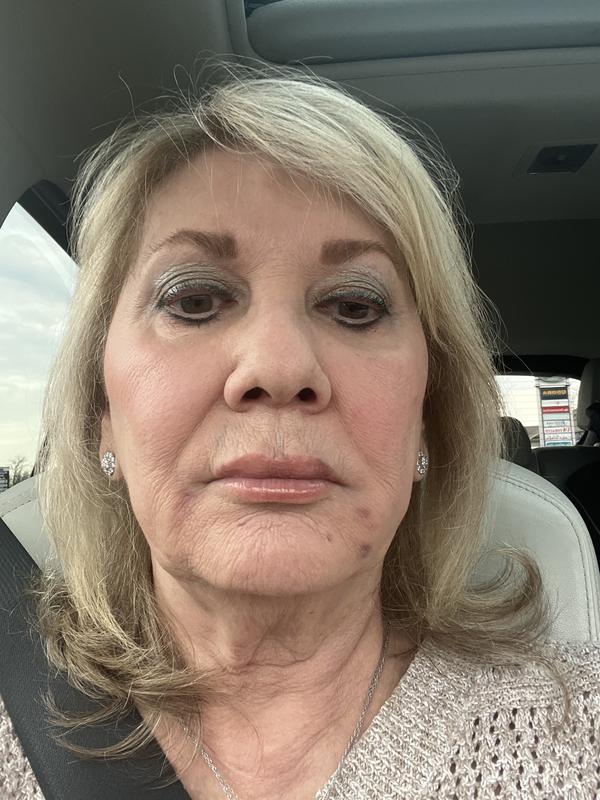 Review Thumbnail Image 2 270411120